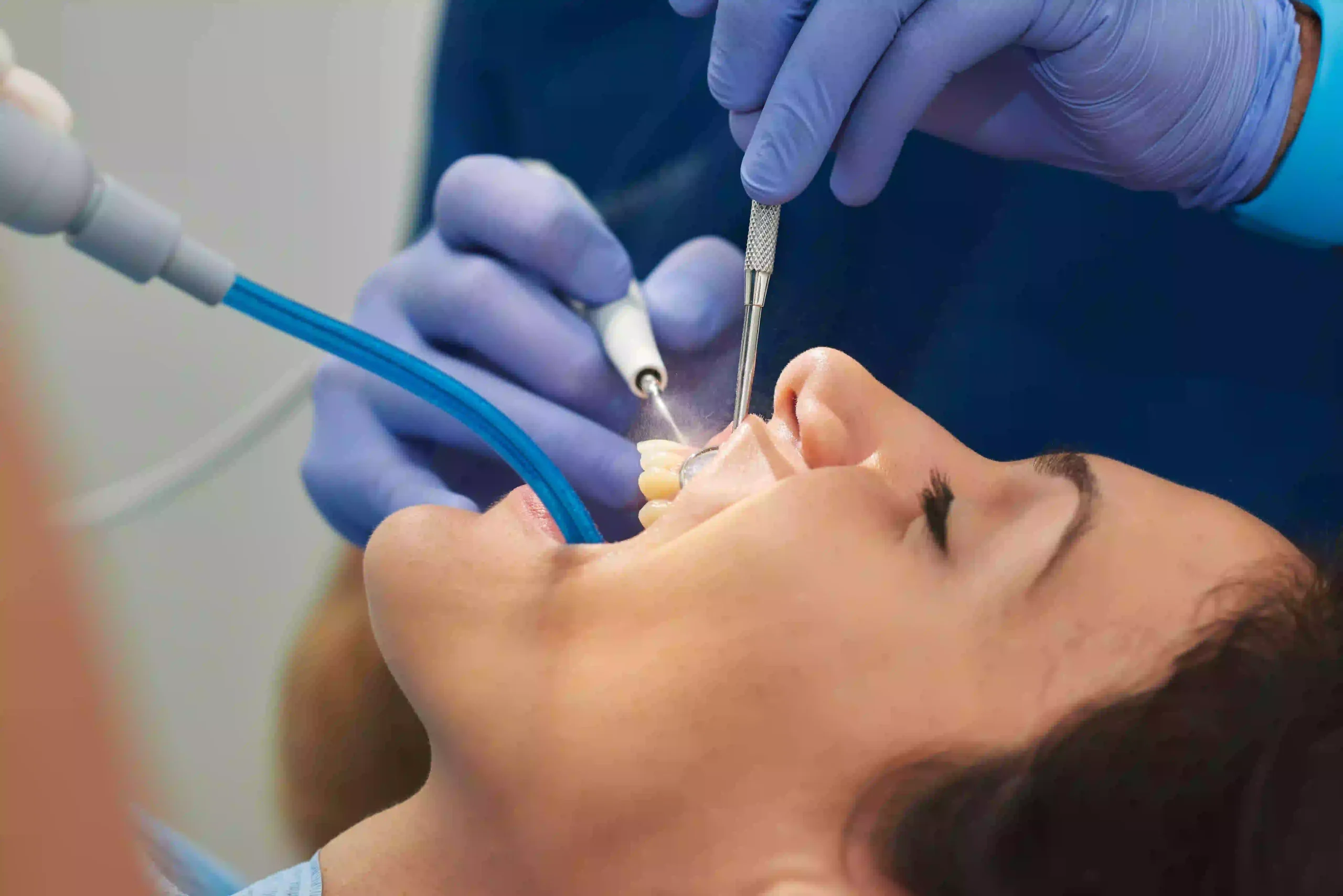 Importancia de las limpiezas dentales regulares
