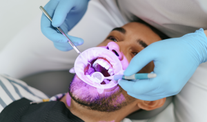 Tipos de blanqueamiento dental