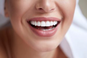 Diferencias entre carillas dentales e implantes dentales